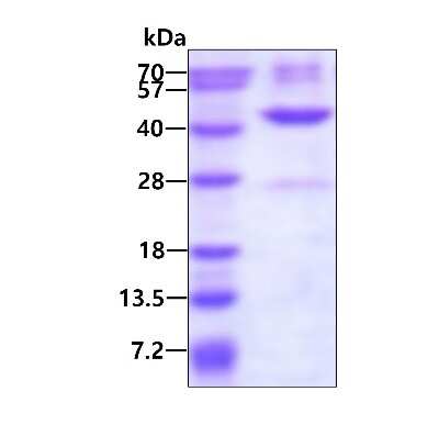 SDS-PAGE: Recombinant Human IDH3G His Protein [NBP1-78823]